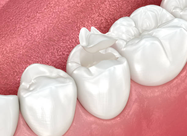 Best Dental Fillings (Composite and Amalgam)  in Dewey, OK